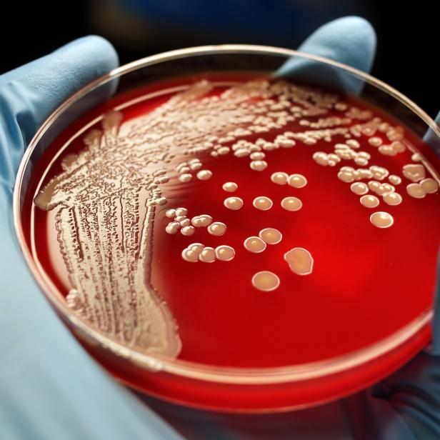 Human hand holding MRSA colonies on blood agar plate.