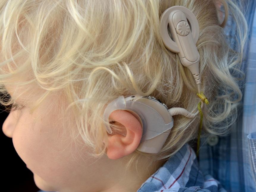 LONG BEACH, CA - MAY 31: LONG BEACH, CALIF. USA --  Noah Larson, 2, on May 31, 2012, in their Long Beach, Calif., home. Noah, was born deaf, he had cochlear implant and now hears almost normally with the help of hearing aids. 
(Photo by Jeff Gritchen/Digital First Media/Orange County Register via Getty Images)