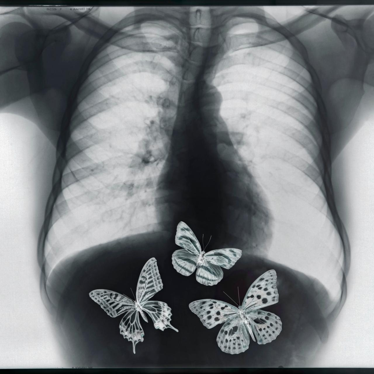 Why Do You Feel Butterflies in Your Stomach?, Latest Science News and  Articles