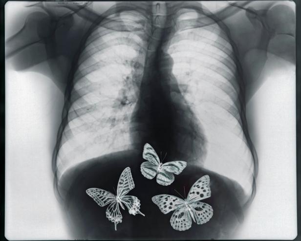 Why Do You Feel Butterflies in Your Stomach Latest Science News