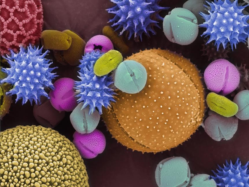 Colorized scanning electron microscope image of pollen grains.  The pollen has been acetolyzed to remove cytoplasm and pollenkit in order to reveal the intricate wall structure.  The image shows a mixture of different pollen species.