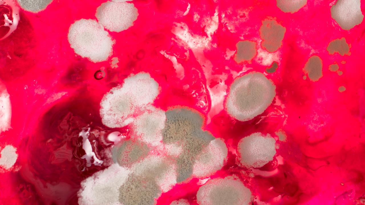 Britain's Collection of Infectious Microbes Celebrates 100 Years