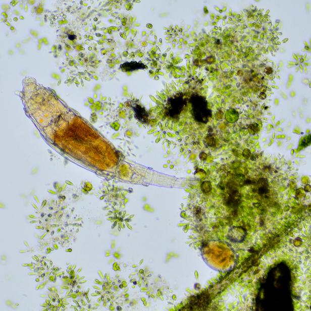 A Bdelloid rotifer feeding on algae and other microorganisms, seen under a microscope