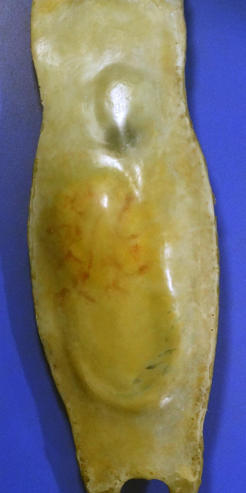 A Mermaid's purse, a casing that surrounds the fertilized eggs of some sharks, skates, and chimaeras. They are made of collagen protein strands (Photo by: Universal History Archive/Universal Images Group via Getty Images)